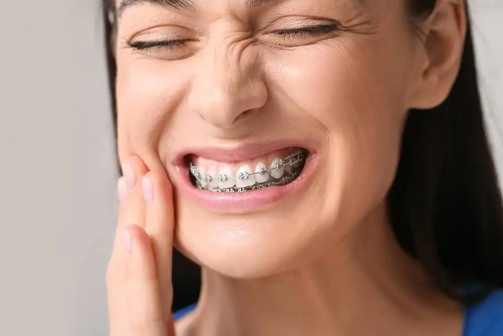 Traditional Braces Orthodontic Dentistry Service