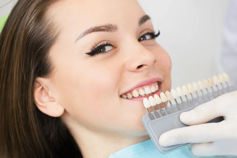 Porcelain veneer shade being matched against a patient's smile