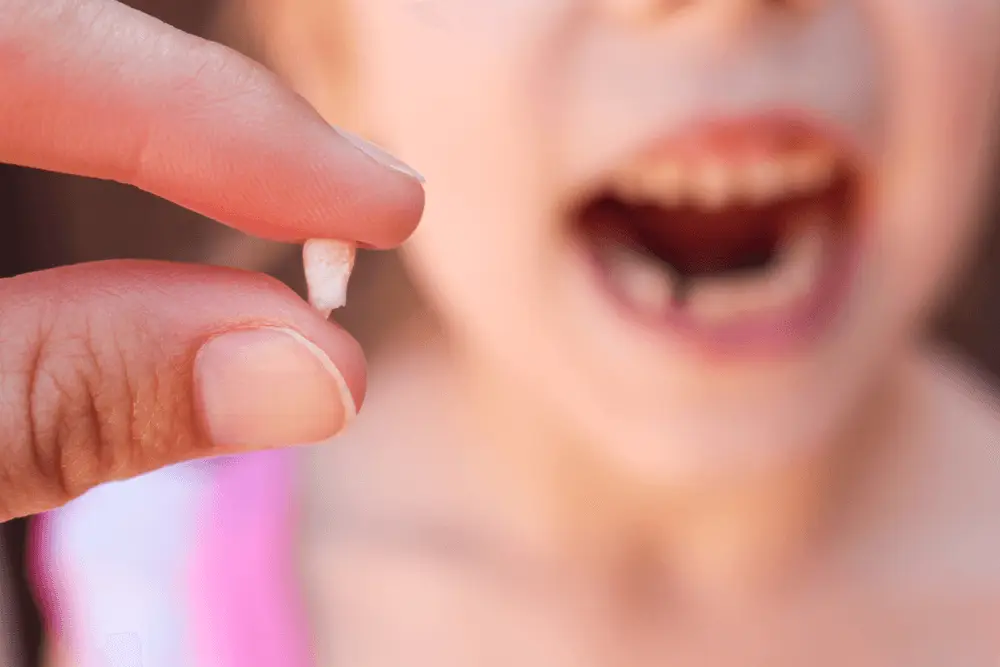 Close-up of a damaged tooth before extraction