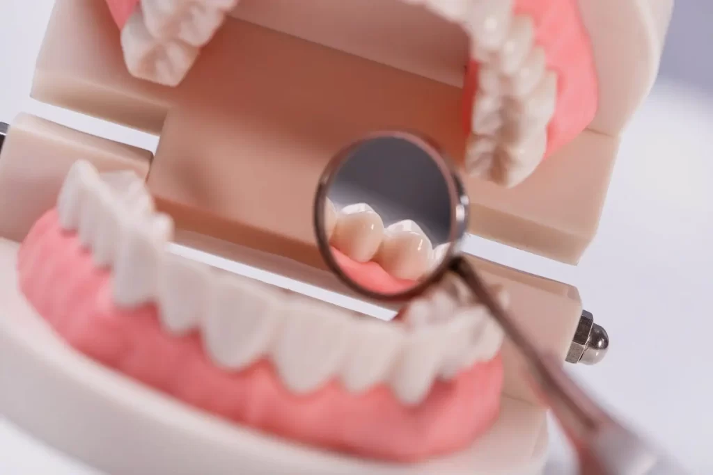 Close-up of a restored white smile