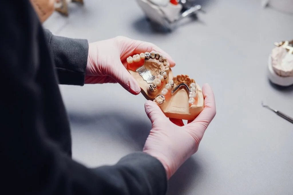 Dental model showing crown and bridge placement