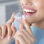 Clear aligners for a confident smile in Aventura FL