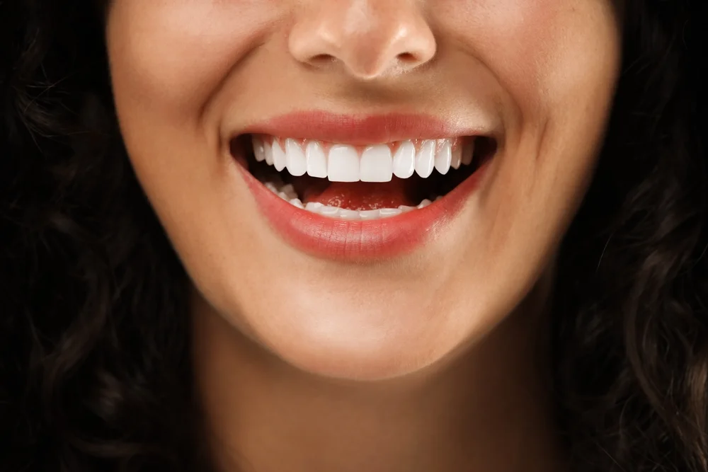 Dental Implants in North Miami