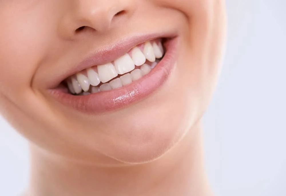 dental implants in miami fl