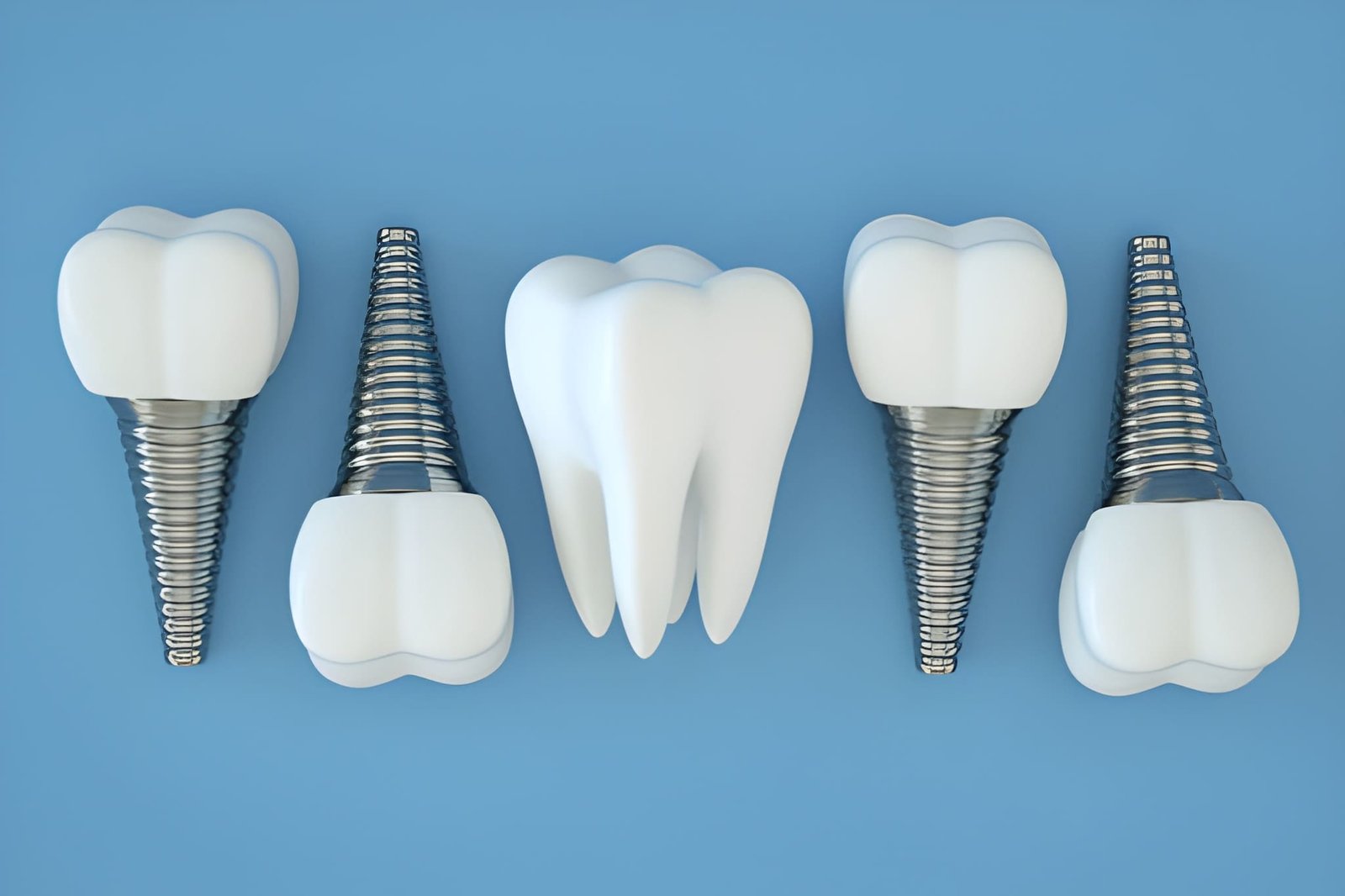 Dental implant consultation for missing tooth replacement in Miami