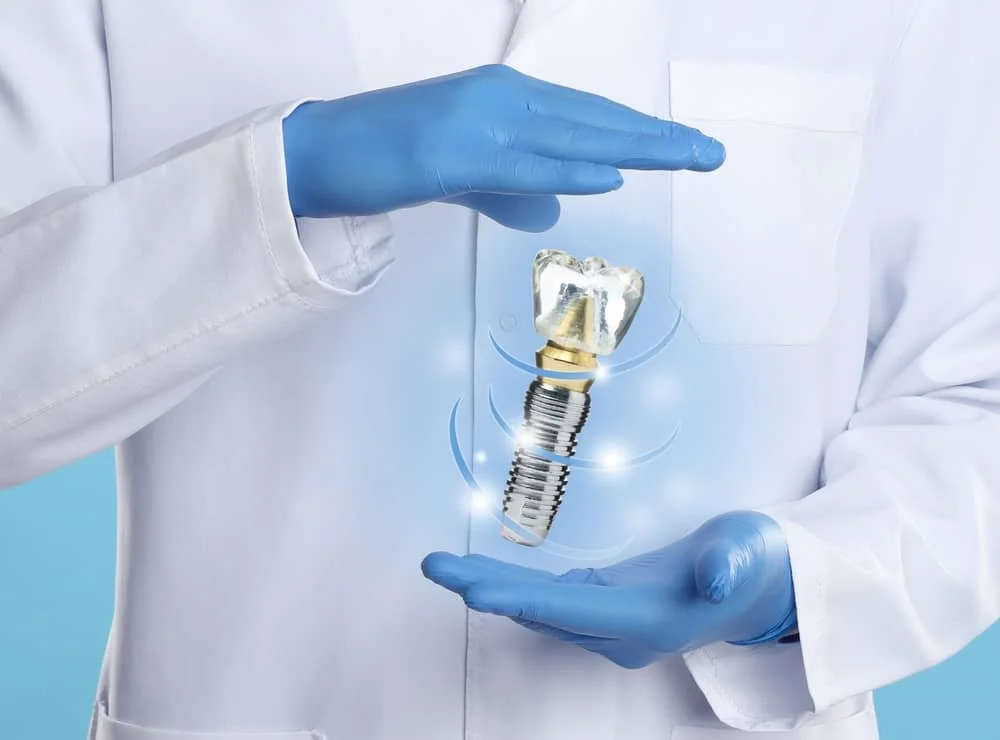 best dental implants miami fl