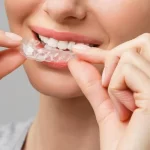 clear aligners in North Miami