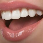 cosmetic dentistry options for a Hollywood smile with a dentist in Aventura, FL